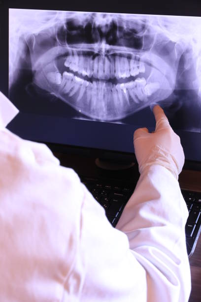 Best Emergency Root Canal Treatment in Washington Terrace, UT